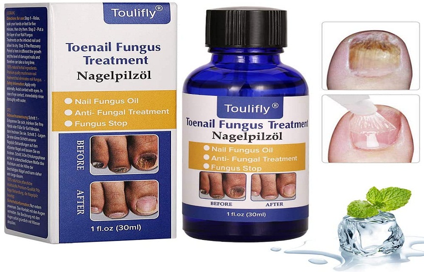 Toenail Fungus: Foot Spray Treatment